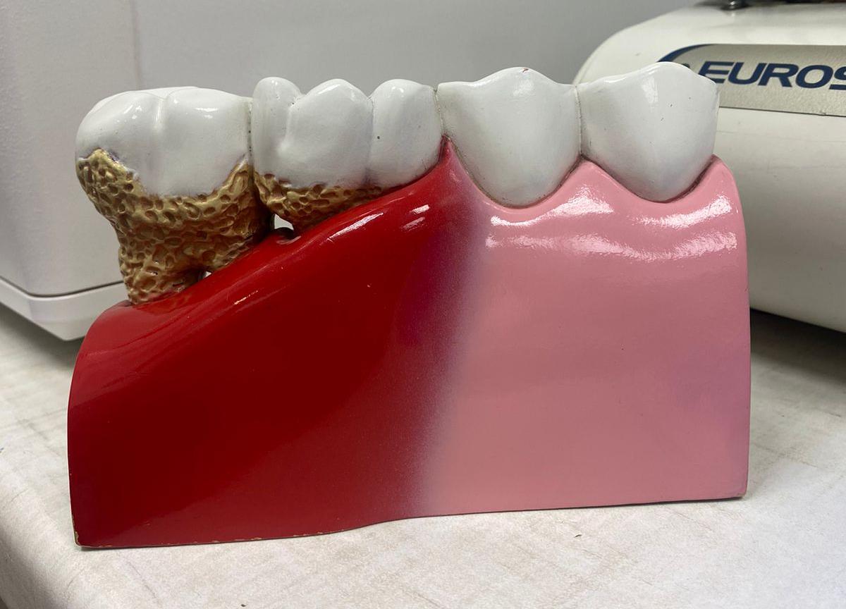 Бывают ли «неизлечимые» зубы?