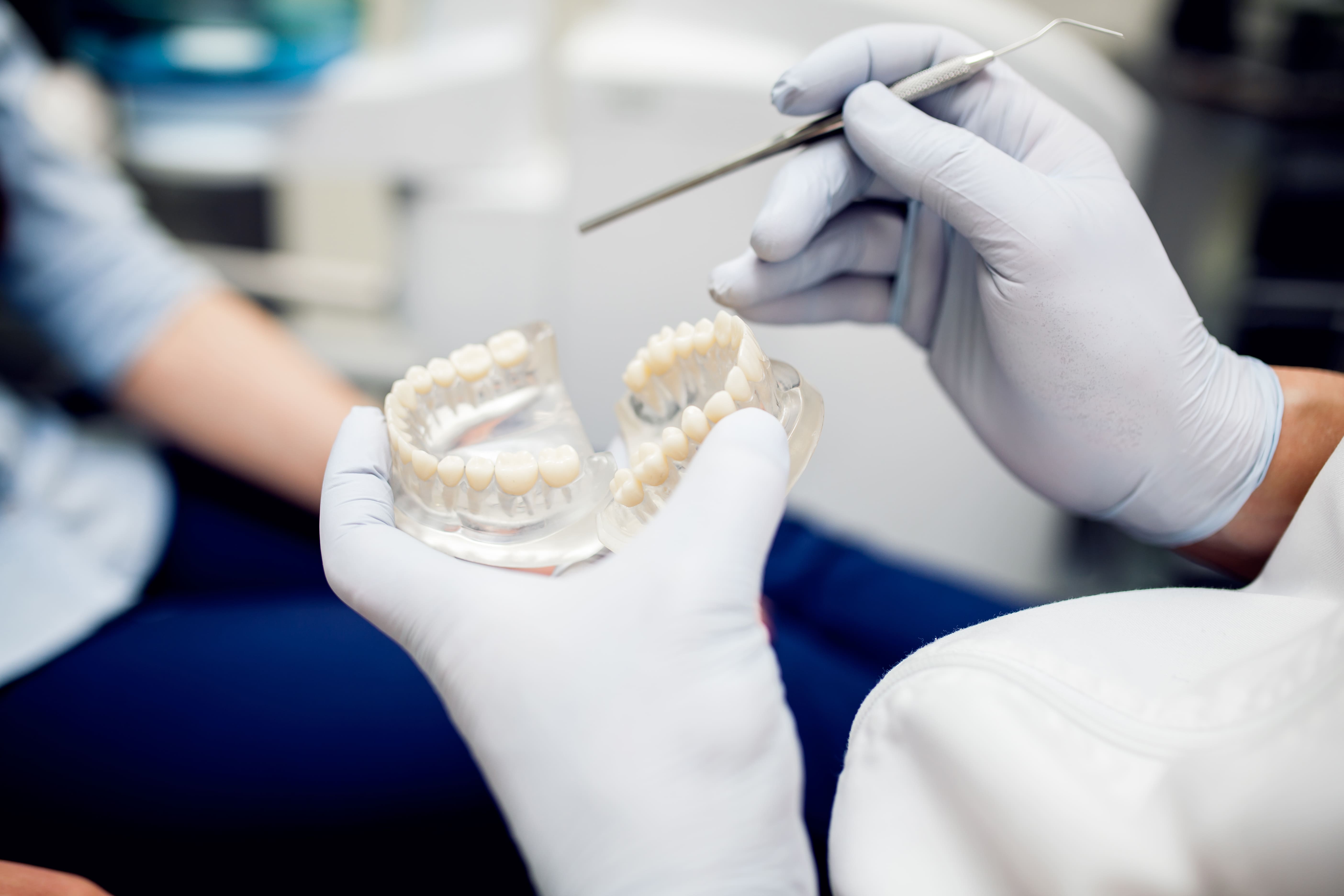 Какие зубные протезы лучше – бюгельные или мостовидные?